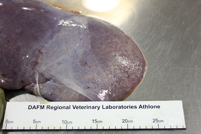 liver fluke